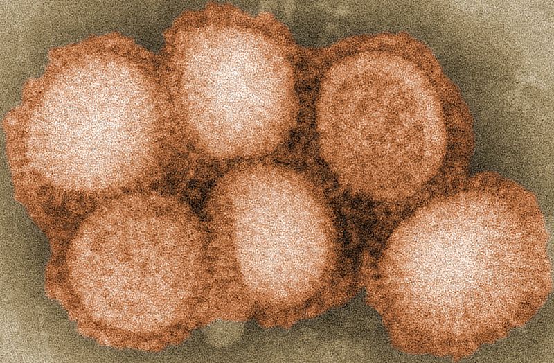 H1N1 swine flu virus